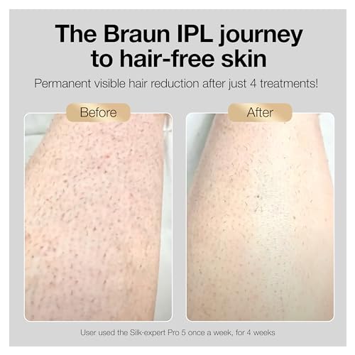 Braun IPL Silk·Expert Pro 5 PL5347 Latest Generation IPL for Women and –  Ideana