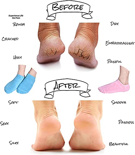 Moisturizing Socks, Gel Socks Soft Moisturizing Gel Socks, Gel Spa Socks for Repairing and Softening Dry Cracked Feet Skins, Gel Lining Infused with Essential Oils and Vitamins